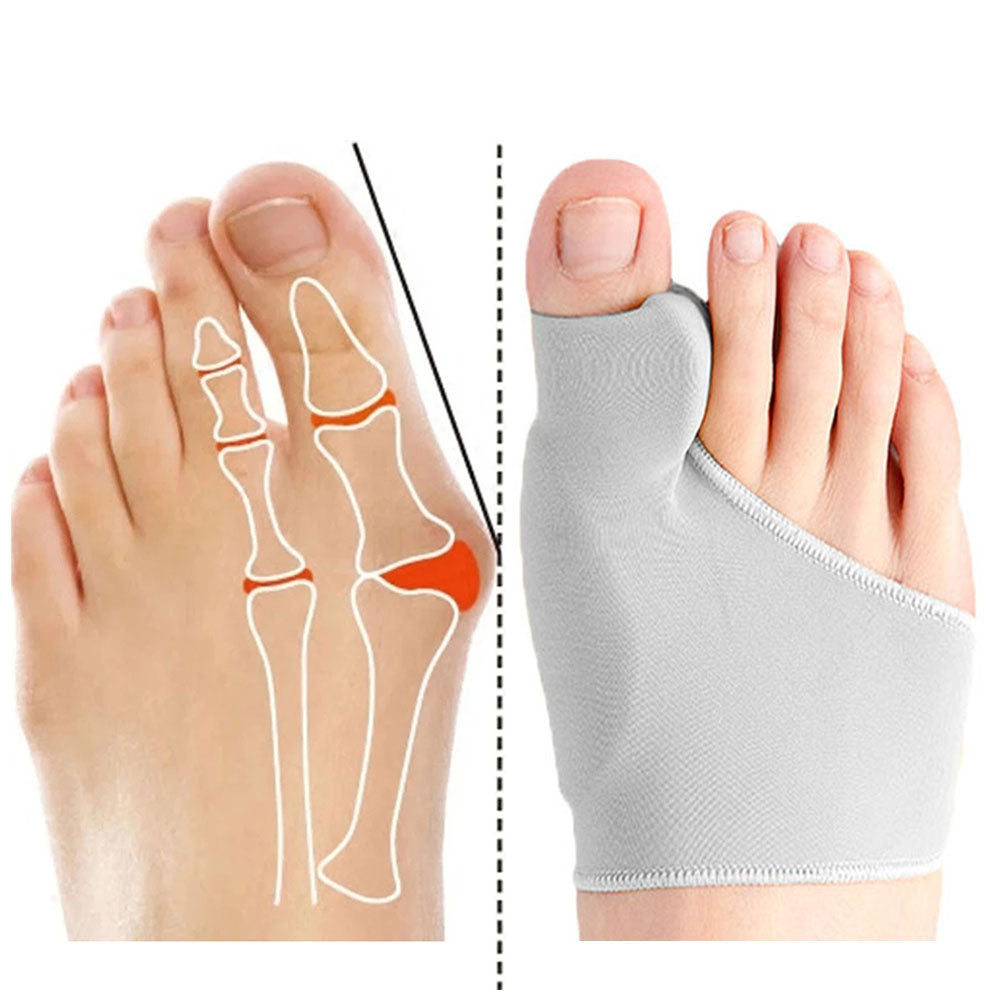 BS Bunion Corrector | Teenseparator en correctie